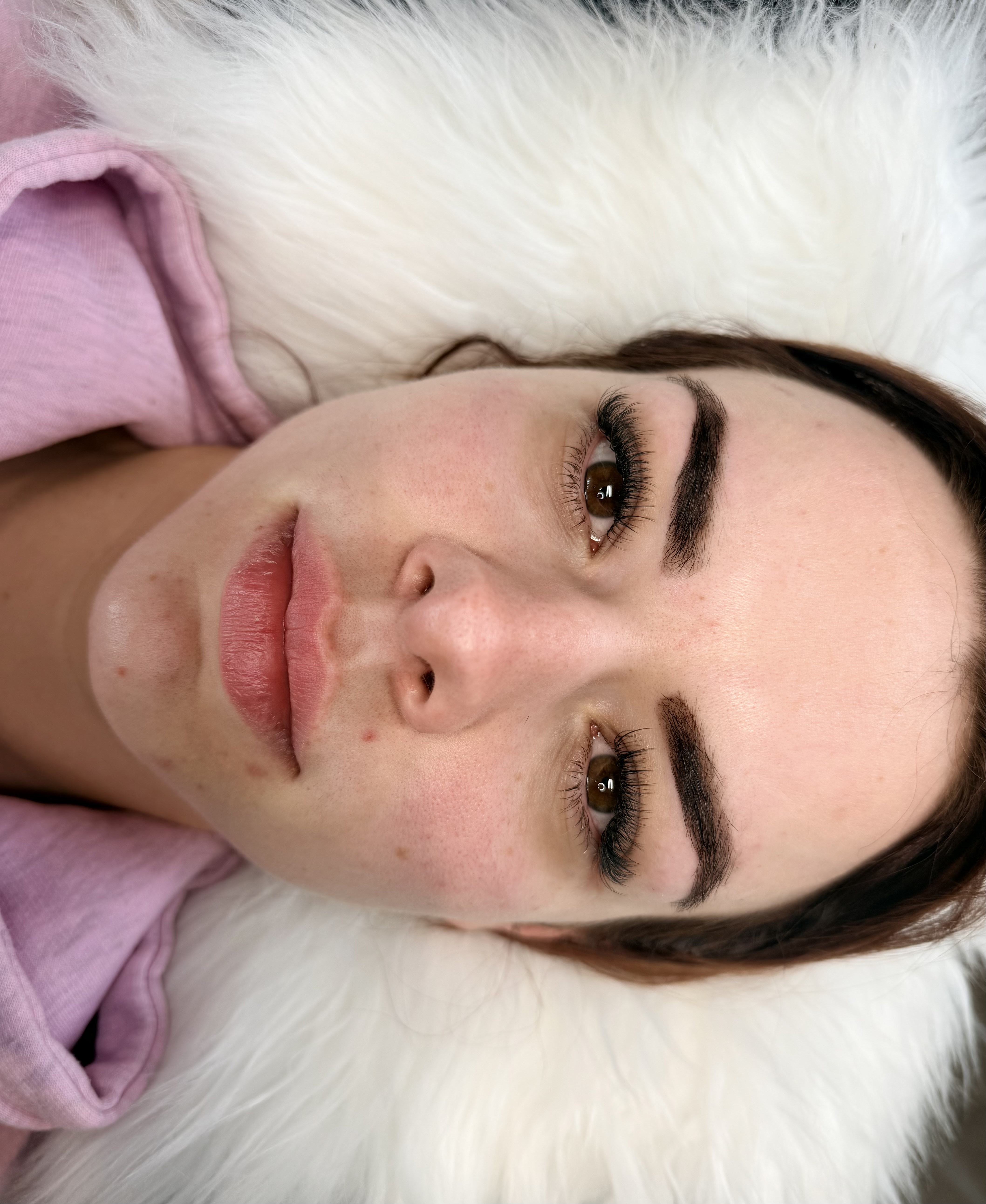 Hybrid lash set, example two